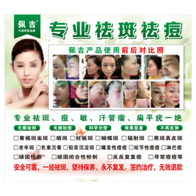 佩吉专业祛斑祛痘