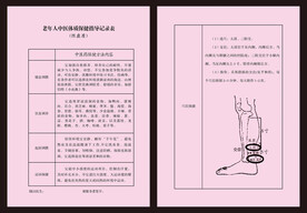 阴虚质