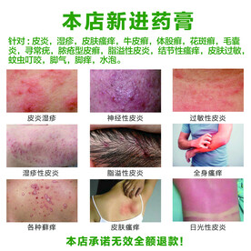 皮肤病