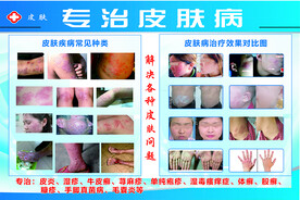专治皮肤病海报