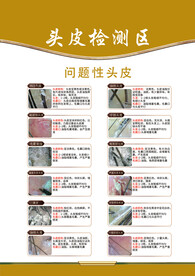 头皮问题