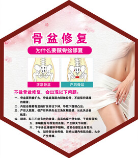 骨盆修复 
