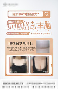 丰胸科普知识 