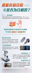 科普医疗海报白癜风海报