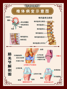 椎体病变示意图