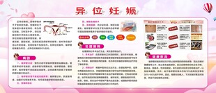 异位妊娠