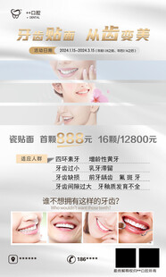 牙科 牙齿贴面