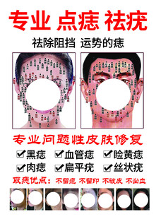 祛斑祛痘
