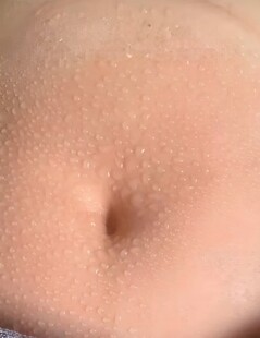 皮肤病