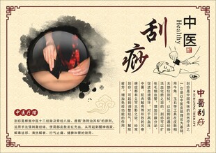 刮痧