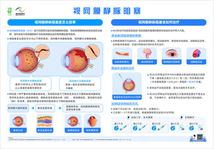 视网膜静脉阻塞