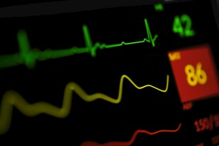 医疗监护仪数据