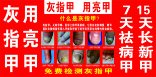 灰指甲