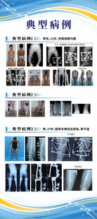 展架易拉宝