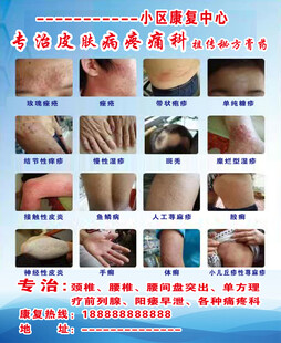 皮肤病 皮肤科