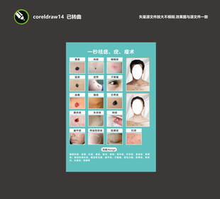 点痣宫 点痣图