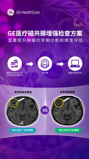 医疗设备
