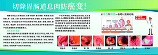 医院胃肠道展板