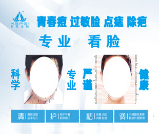痣相图