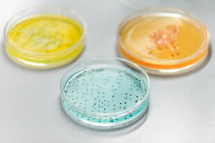 培养皿中的多彩微生物样本