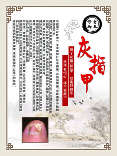灰指甲