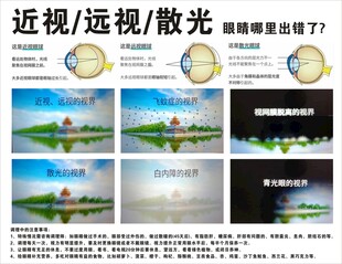 视力矫正宣传素材展示