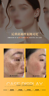 美业案例对比图