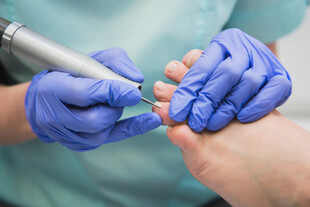 足部护理治疗操作场景