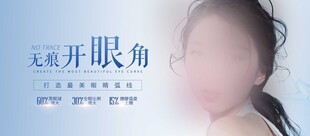 开眼角手术示例