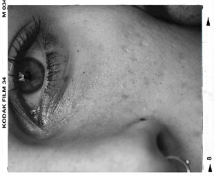 特写眼部肌肤细节