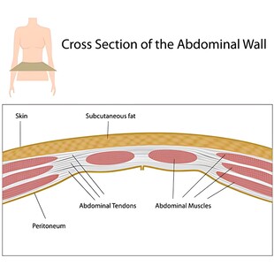 腹壁横截面解剖图