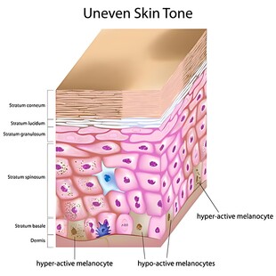 皮肤结构示意图