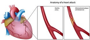 心脏结构与血管示意图