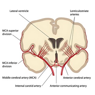 脑部血管解剖结构示意图