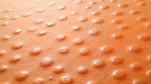 橙色凸点纹理表面