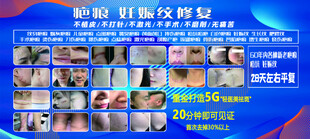 疤痕修复 康复 妊娠纹修复