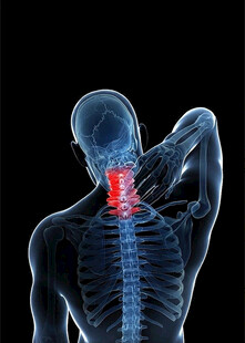 颈部疼痛示意图