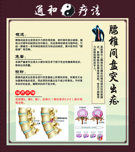腰椎间盘突出症治疗科普