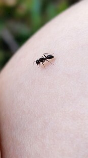 手臂上的小蚂蚁