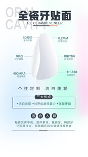 全瓷开贴面产品介绍