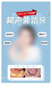 超声波洁牙宣传海报