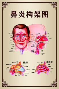 鼻炎结构示意图