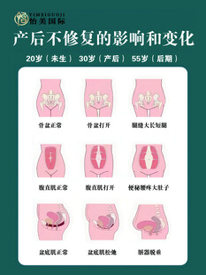 产后不修复的形态变化