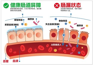 肠道健康