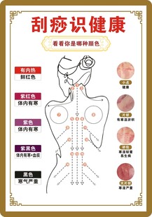 刮痧识健康