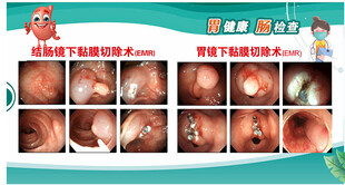 胃肠 内镜 消化科