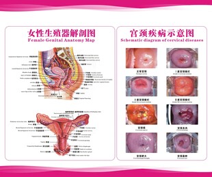 女性生殖系统疾病图示