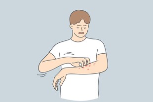 男子挠手臂