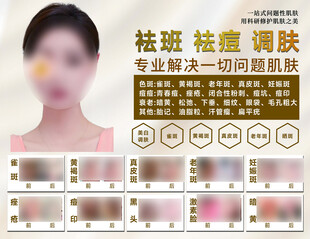 祛斑祛痘 肌肤焕新方案