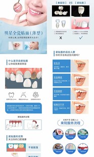 全瓷贴面